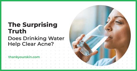 Does Drinking Water Help Clear Acne Hint Yes
