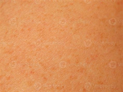 Human Skin Texture In Various Parts Of The Body 3644330 Stock Photo At