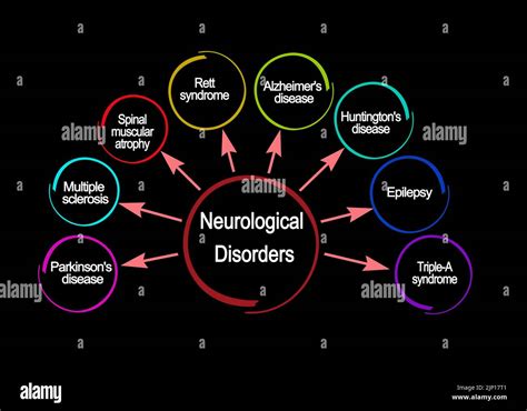 Eight Neurological Disorders Stock Photo Alamy