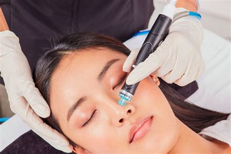 Hydrafacial Chester Cheshire Pure Perfection Clinic