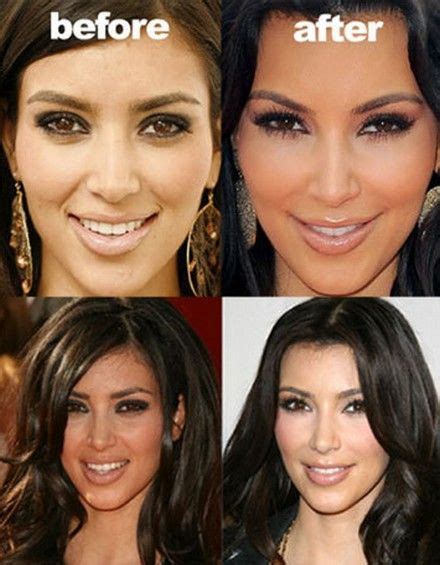 Kim Kardashian Face Before And After Plastic Surgery Celebrity
