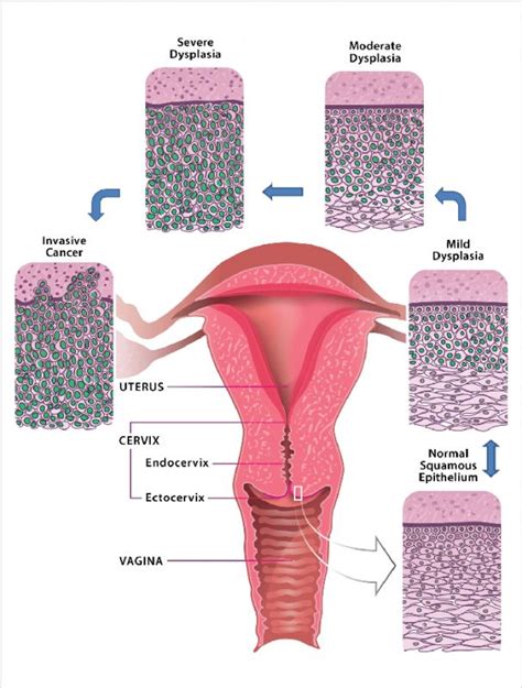 Vagina Cross Section Sex Cumception
