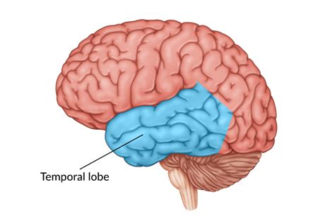 Temporal Lobe Stroke Causes Secondary Effects And Recovery
