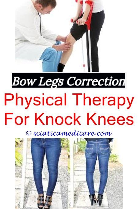 Knock Knees Cure Bow Legged Bow Legged Correction Knock Knees