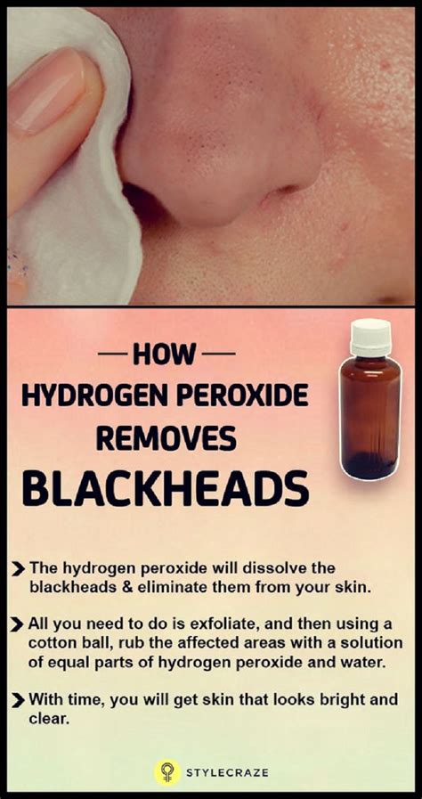 So how to remove blackheads? How to Get Rid of Blackheads - 15 Blackhead Removal DIYs ...