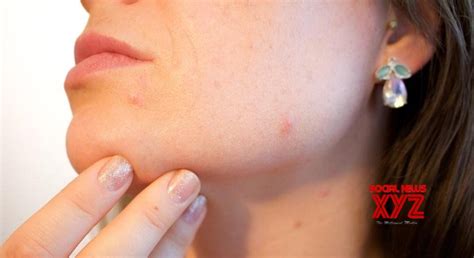 Skin Problem That Indicate Serious Underlying Health Issues Social