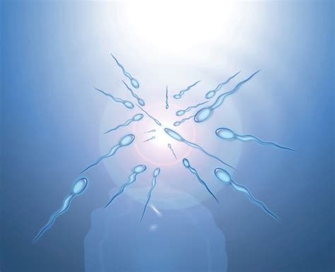 Varicocele Y Fertilidad Masculina Causas Diagnóstico Y Tratamiento