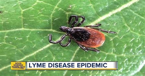 Doctors Predict Lyme Disease Epidemic This Year