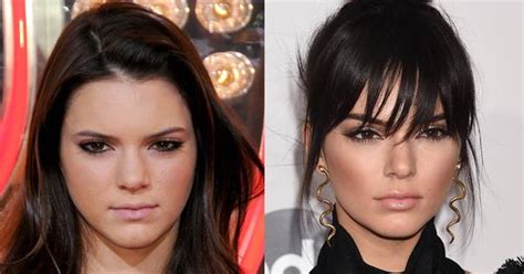 Kendall Jenners Before And After Beauty Evolution Elle Australia