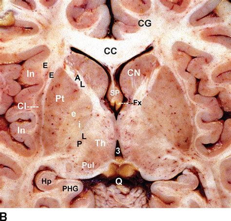 Anatomy Of Thebrain Filntouch