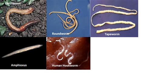 Melissas Biology Learning Blog Identifying Worms