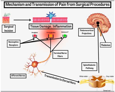 Jcm Free Full Text Multimodal Pain Management In Orthopedic Surgery