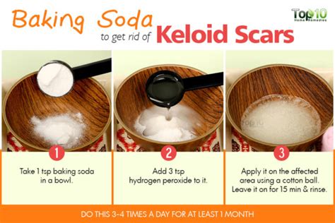 Coconut oil for acne scars. Natural Remedies to Heal Keloid Scars - Our Motivations