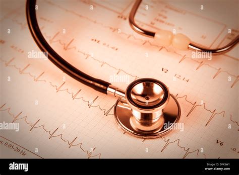 Ecg Heartbeat Report With A Stethoscope Stock Photo Alamy