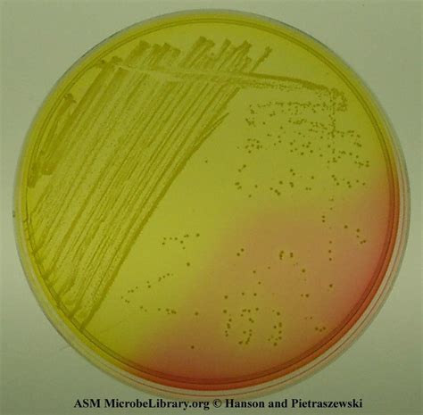 Mannitol Salt Agar Principle Uses And Results • Microbe Online