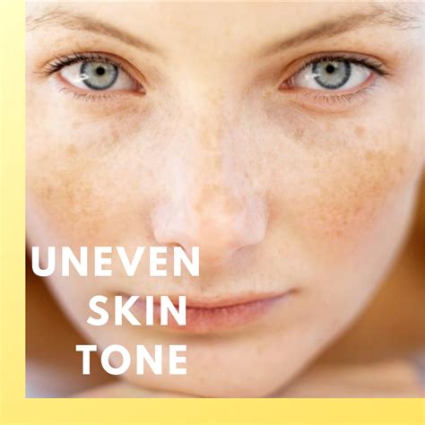 Uneven Skin Tone Treatment Beauty Grace