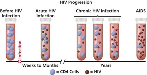 Symptoms Hiv Aids Database