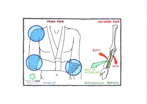 Frattura polso riabilitazione a casa - Guida COMPLETA