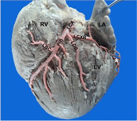Anterior View Of The Heart La Left Atrium Lv Left Ventricle Rv