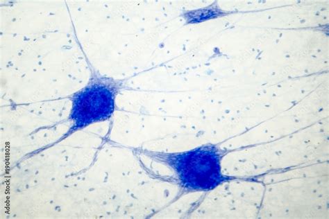 Histology Of Human Brain Tissue Photo Under Microscope Light