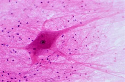 Multipolar Neuron Light Micrograph Stock Image C0184479 Science