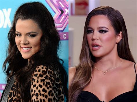khloe kardashian confirms she s had one nose job after rampant plastic surgery speculation