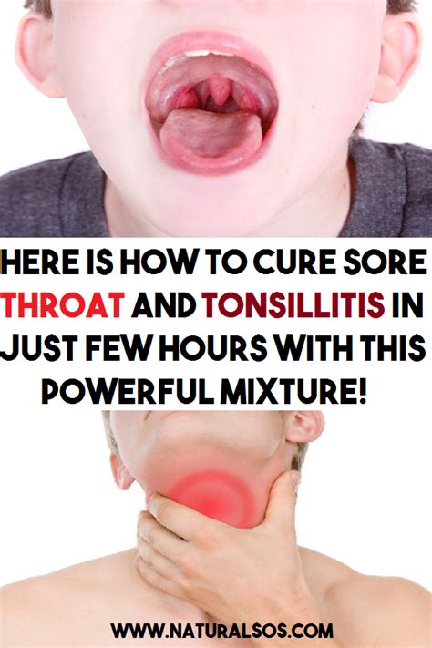 Here Is How To Cure Sore Throat And Tonsillitis In Just Few Hours With This Powerful Mixture