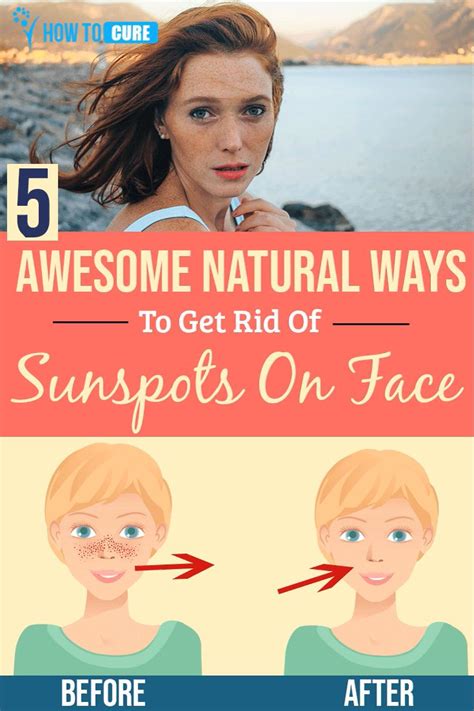 5 Wondrous Natural Ways For How To Get Rid Of Sunspots On Face Video