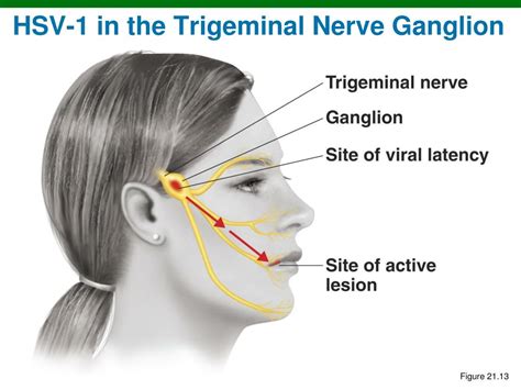 Trigeminal Nerve Ganglion Hot Sex Picture