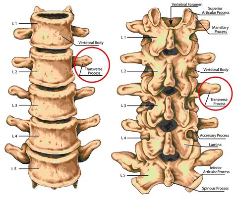 Transverse Process Fractures A Broken Spine From Crashing