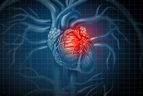 Case Study Cardiovascular Complications Of Chronic Obstructive