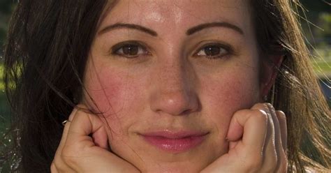 Warm Red Or Rosy Cheeks Causes And What To Do