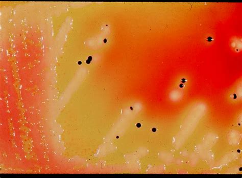 B410 8 Escherichia Coli And Salmonella Derby On Xld Agar Flickr