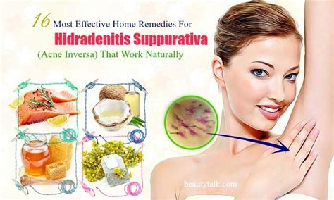 What Is Hs How To Get Rid Of Hidradenitis Suppurativa Hidradenitis My