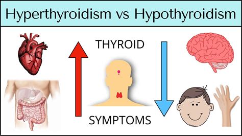 Hyperthyroidism Vs Hypothyroidism Symptoms Made Easy Thyroid