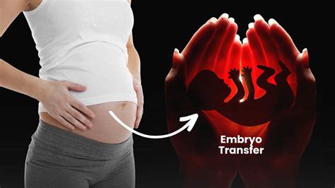 What Is Embryo Transfer And How Does It Work In Ivf