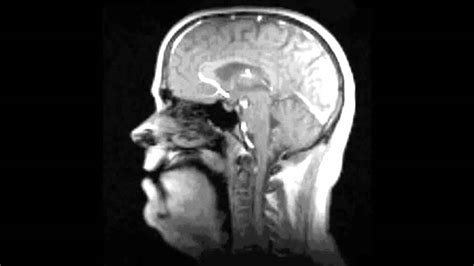 Fast Mri Technique Captures Neuromuscular Movements In Real Time Youtube
