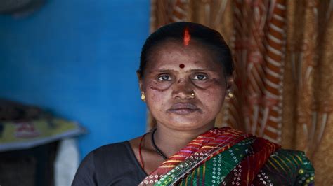 Magazine Meet The Indian Women Hunted As Witches Human Rights Al Jazeera