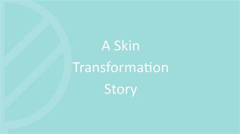 A Skin Transformation Story with Alma Hybrid Laser Treatment at Oak