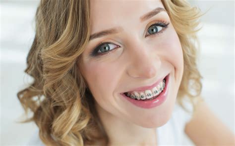 Big Benefits Of Braces In Your Adult Years Doyle Orthodontics