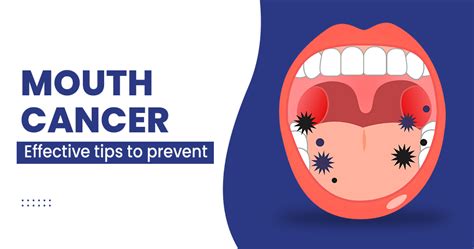 10 Proven Ways To Prevent Oral Cancer