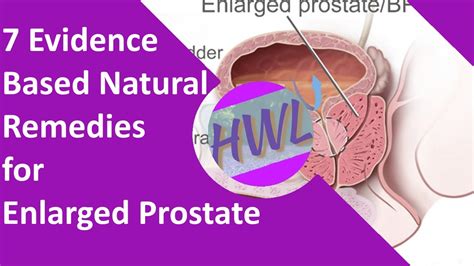 7 Evidence Based Natural Remedies For Enlarged Prostate Youtube