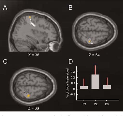 Figure 3 From The Cutaneous Rabbit Illusion Affects Human Primary