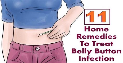 11 Effective Home Remedies To Treat Belly Button Infection Infected