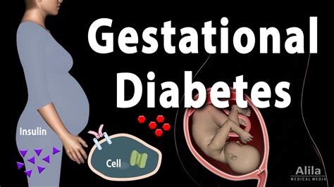 Gestational Diabetes Animation Youtube