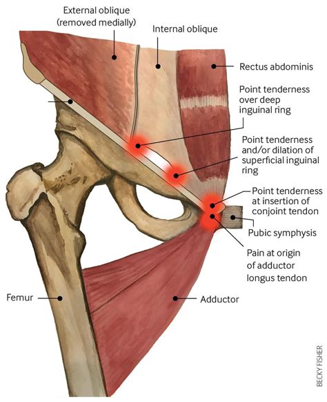 Groin Muscle Anatomy Male Anatomy Of Groin And Adductors The Groin