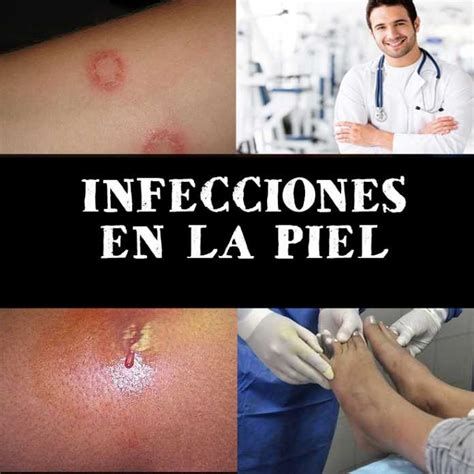 Álbumes 105 Foto Fotos De Infecciones En La Piel Mirada Tensa
