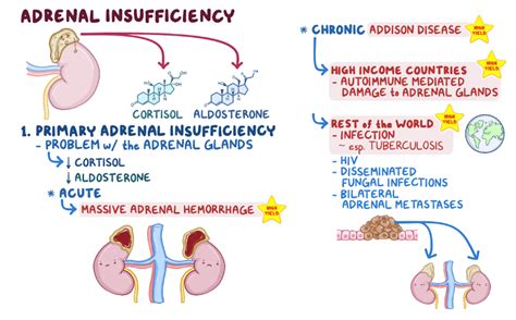 Study Tips USMLE Step 1 Question Of The Day Adrenal Insufficiency