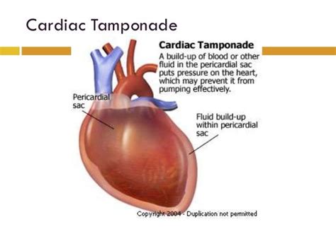 Pericardium Anatomy