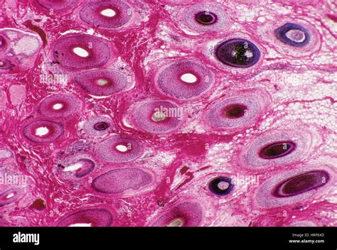 Scalp Hair Follicle Micrograph Hi Res Stock Photography And Images Alamy